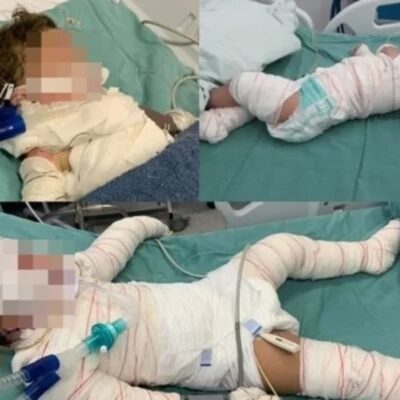 Bebê de 11 meses morre após explosão de churrasqueira em Cuiabá