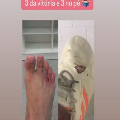 Norberto compartilhou em rede social o corte sofrido no pé e como ficou a chuteira — Foto: Reprodução