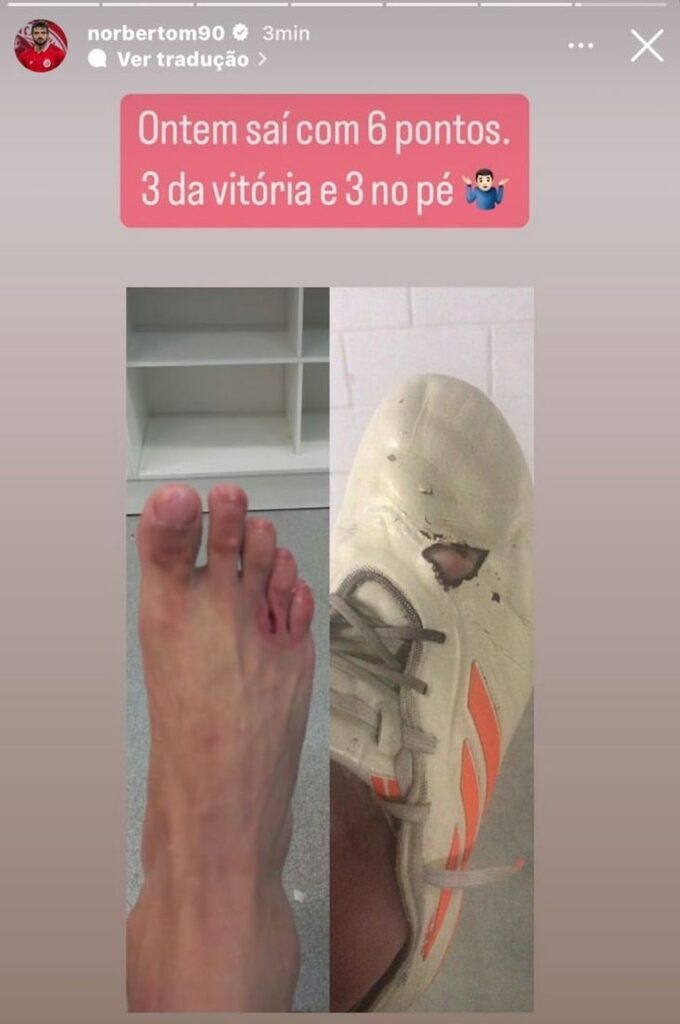 Norberto compartilhou em rede social o corte sofrido no pé e como ficou a chuteira — Foto: Reprodução