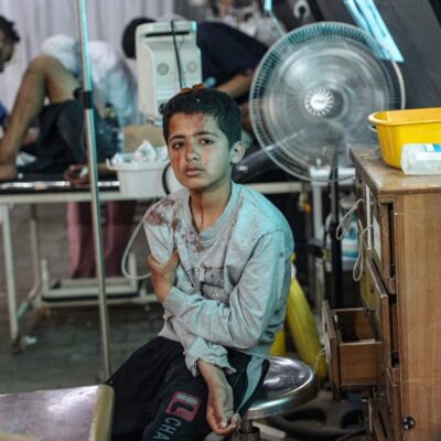 Um menino palestino ferido espera atendimento no hospital de Kuwaiti, no sul de Gaza, após bombardeio em Rafah