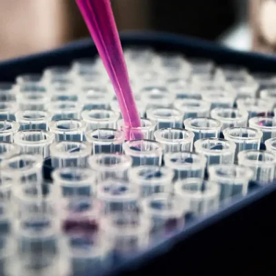Laboratório médico, medicina. Foto: Louis Reed/Unsplash