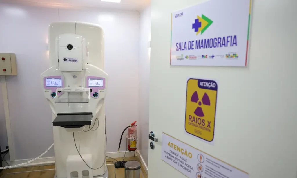 Brasília (DF) 23/10/2025 - Equipamento de mamografia da carreta de saúde da mulher do programa Agora Tem Especialistas no estacionamento do Hospital Regional de Ceilândia, cidade satélite de Brasília Foto: Fabio Rodrigues-Pozzebom/ Agência Brasil