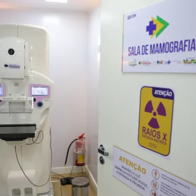 Brasília (DF) 23/10/2025 - Equipamento de mamografia da carreta de saúde da mulher do programa Agora Tem Especialistas no estacionamento do Hospital Regional de Ceilândia, cidade satélite de Brasília Foto: Fabio Rodrigues-Pozzebom/ Agência Brasil
